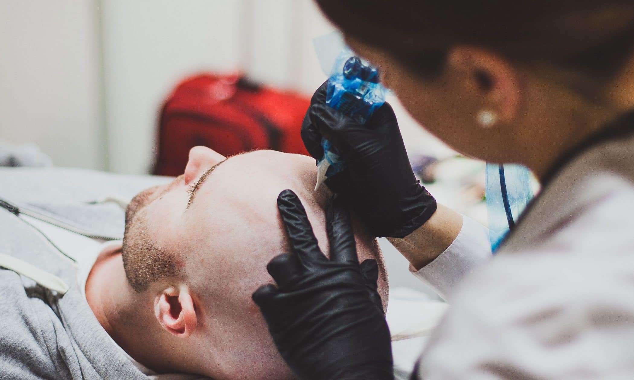 scalp micropigmentation atlanta
