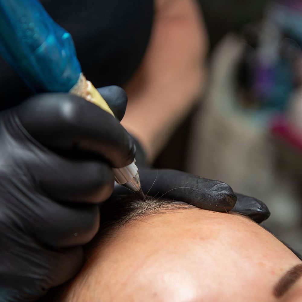 scalp micropigmentation in action on a woman
