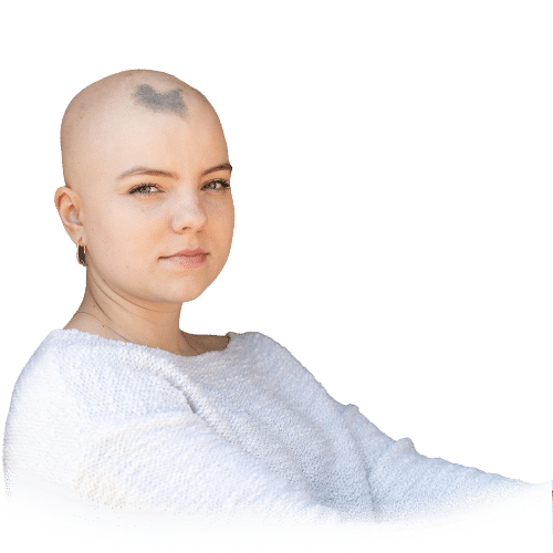 woman with alopecia atlanta